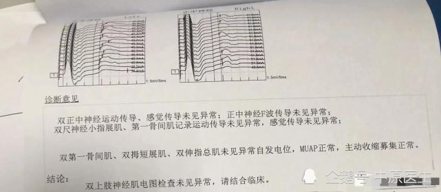 渐冻症|女子通过网络上的科普把自己诊断为渐冻症，做了一堆检查，被专家排除