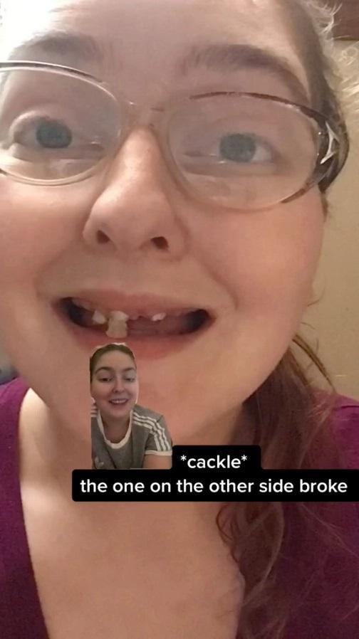 美国女子孕期常喝可乐牙齿腐烂脱落现只剩3颗只能装假牙