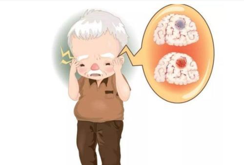 脑梗|脑梗患者如何康复，什么时候康复最好？