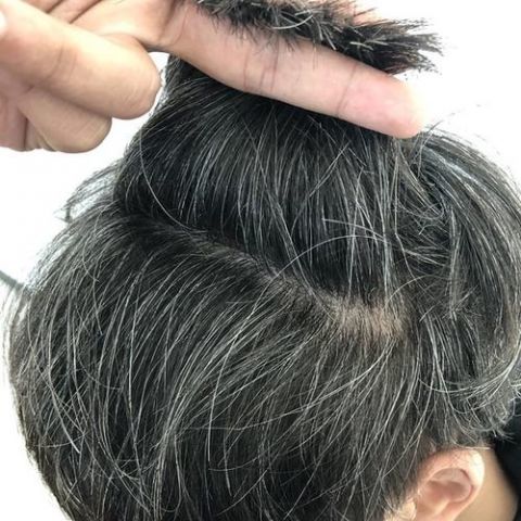 白发增多怎么办注意生活方式和情绪变化可减少白发