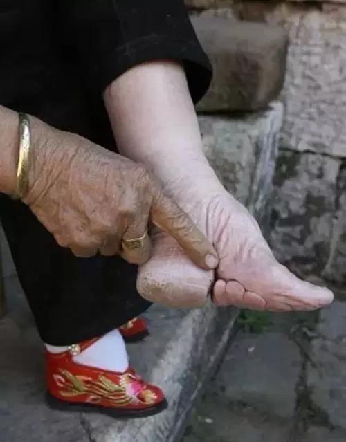 鲜卑族的脚趾头图片