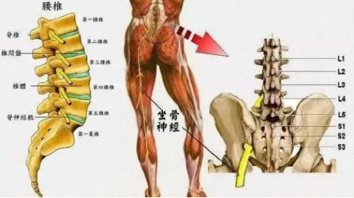 骨科医生辟谣腰突不是骨头错位不能乱按