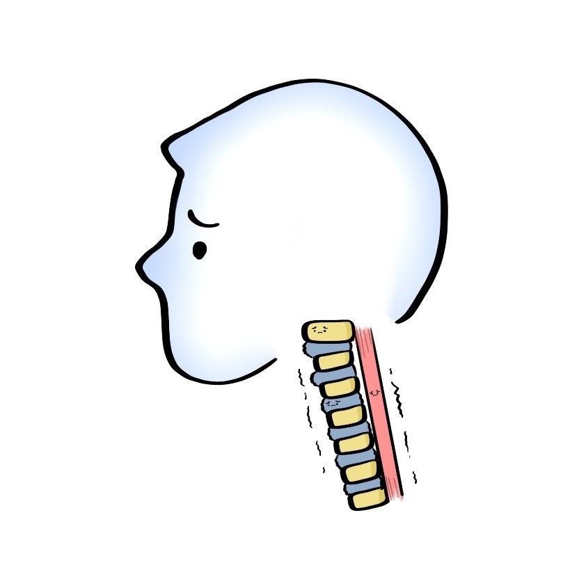 颈椎|体检查出“颈椎曲度变直”是什么意思？是手机玩太多的锅吗？