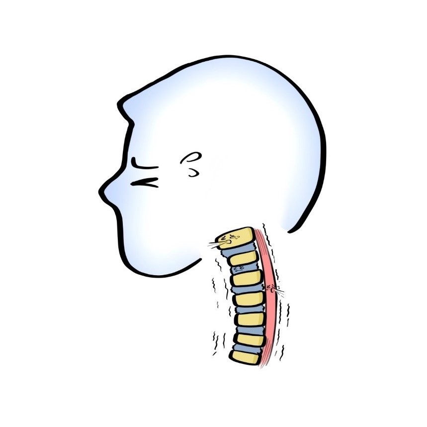 颈椎|体检查出“颈椎曲度变直”是什么意思？是手机玩太多的锅吗？