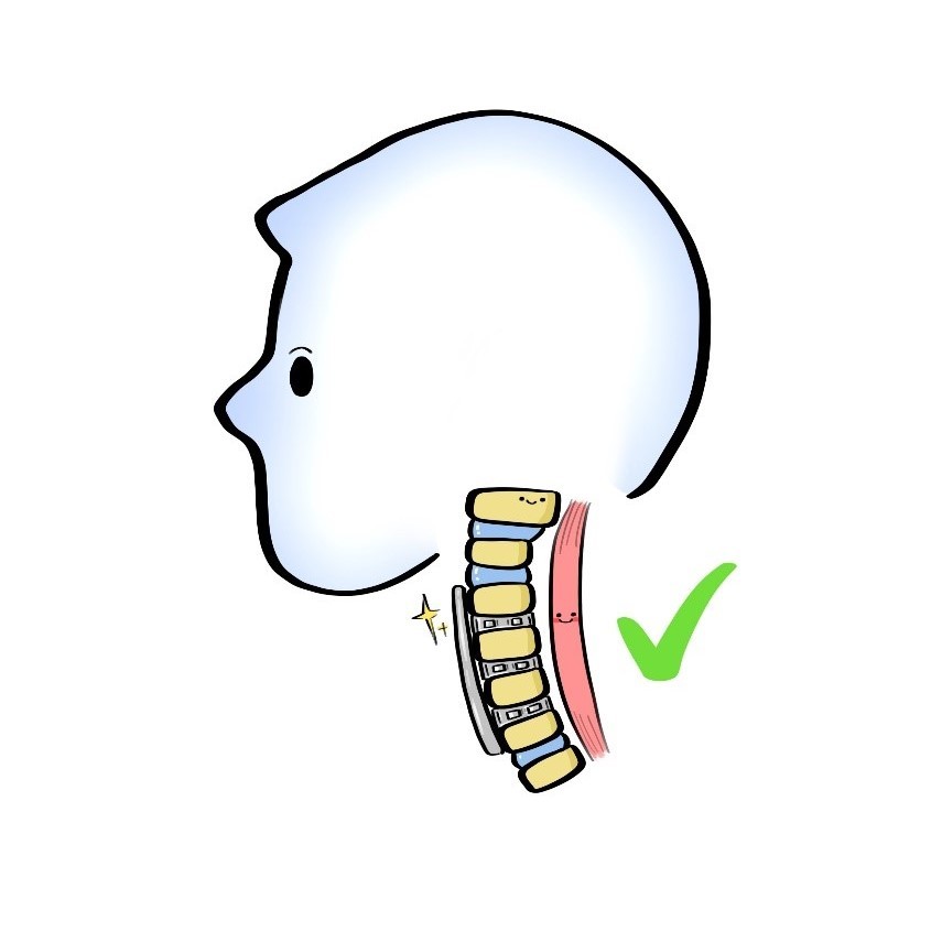 颈椎|体检查出“颈椎曲度变直”是什么意思？是手机玩太多的锅吗？