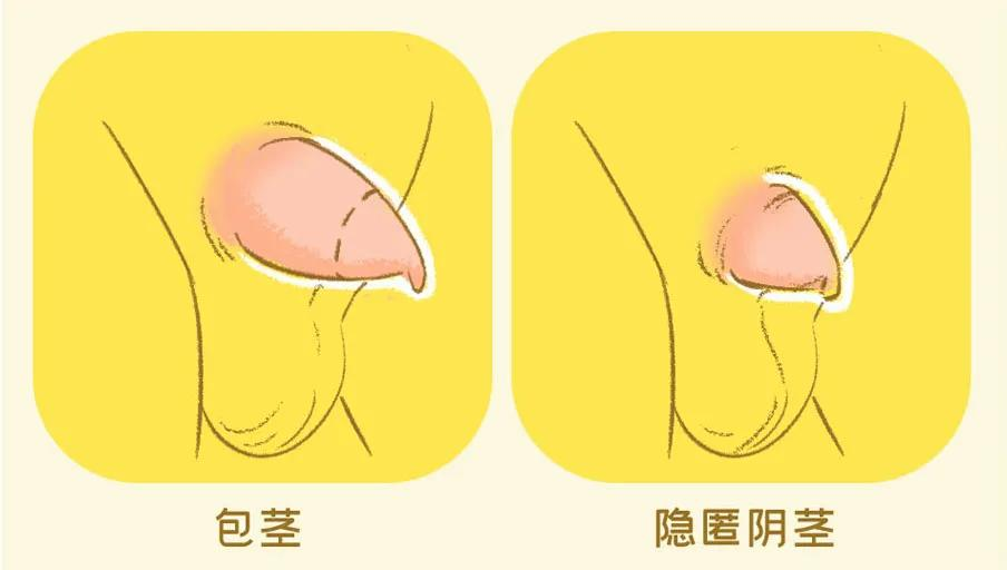 小心耽误孩子男宝蛋蛋出现这几种情况要重视越早检查越好