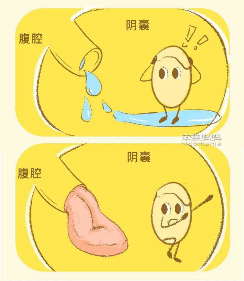 小心耽误孩子男宝蛋蛋出现这几种情况要重视越早检查越好