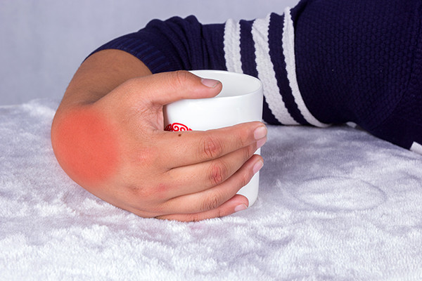 嘌呤|想要降尿酸，控制好嘌呤摄入是重点，哪些食物要少吃？