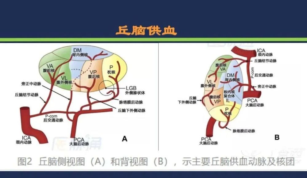 从梗死部位推测责任血管 脑血管解剖 腾讯新闻