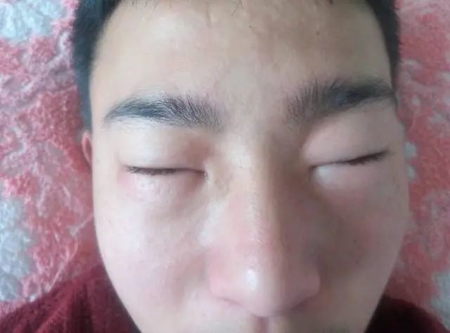 42岁男子,查出尿毒症,透析维持活命,悔哭:年轻时太无知,不知克制_腾讯