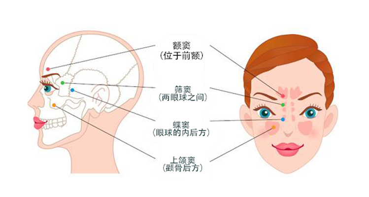 化脓性中耳炎|耳鼻喉科医生提醒：鼻窦炎治不好可能会引起中耳炎！