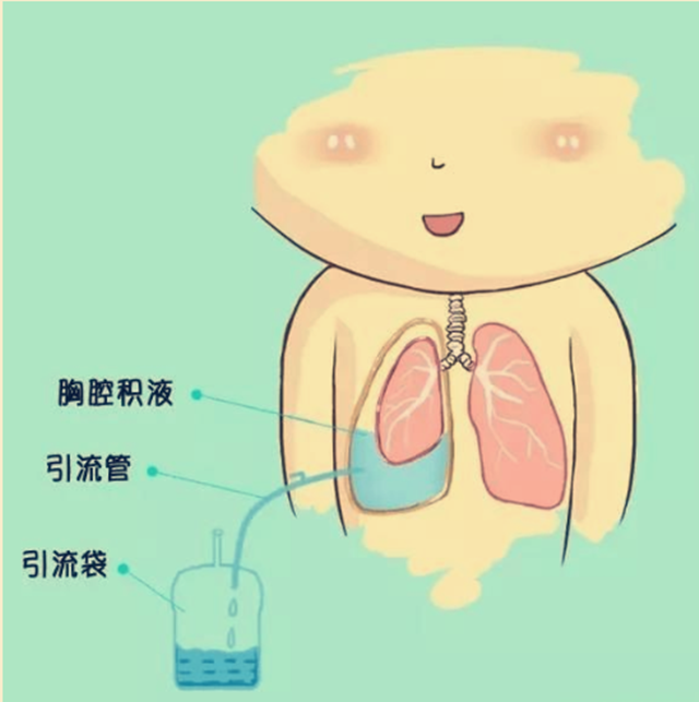 看中医效果显著而忽视病情,发现肿瘤已是晚期,治疗后复发咋办?