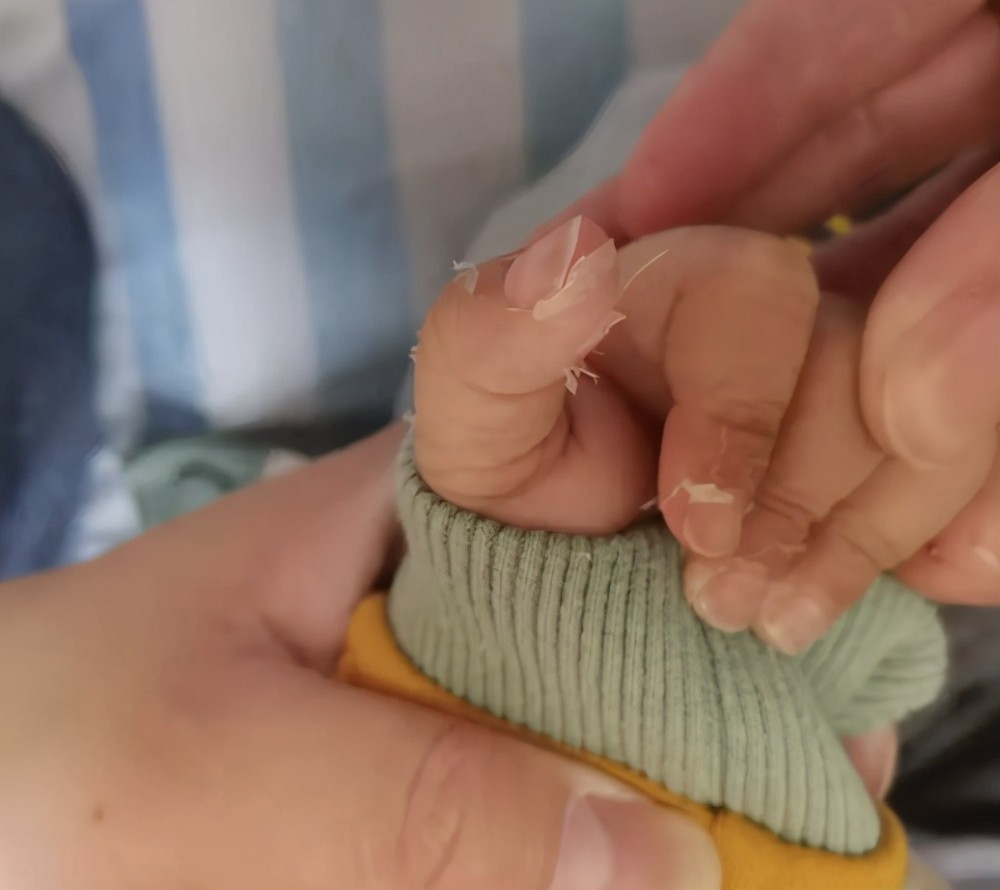 反复发烧|12天！1岁男孩反复发烧不退，5步教你快速识别这种病