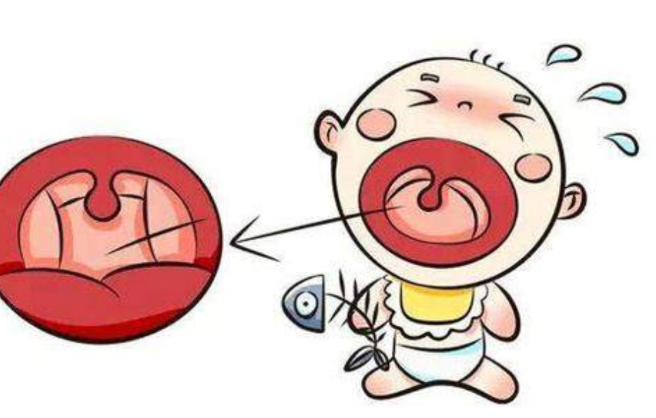 鱼刺卡喉急死人吃醋还是吞饭90的家长都在用错误方法自救