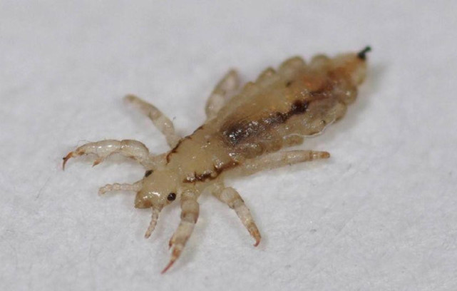 三十年前几乎每人头上身上都有的虱子为何突然间消失不见了