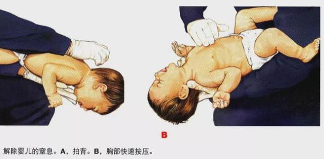 名医专访南方医科大学深圳医院程超儿童呼吸道异物常见问题