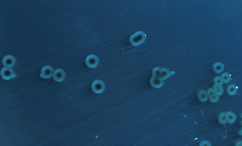 鸡蛋|78 岁老太生吃鸡蛋反复感染，女儿一句话暴露真凶：HIV 阳性！