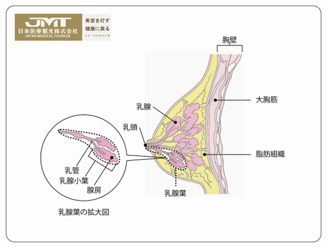 Jmt日本癌症治疗 日本治疗乳癌指南 淋巴结 乳腺癌 癌症 乳房 乳腺