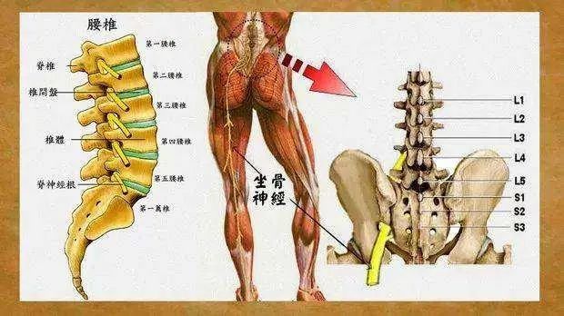 三个动作缓解坐骨神经痛,躺着就能做!