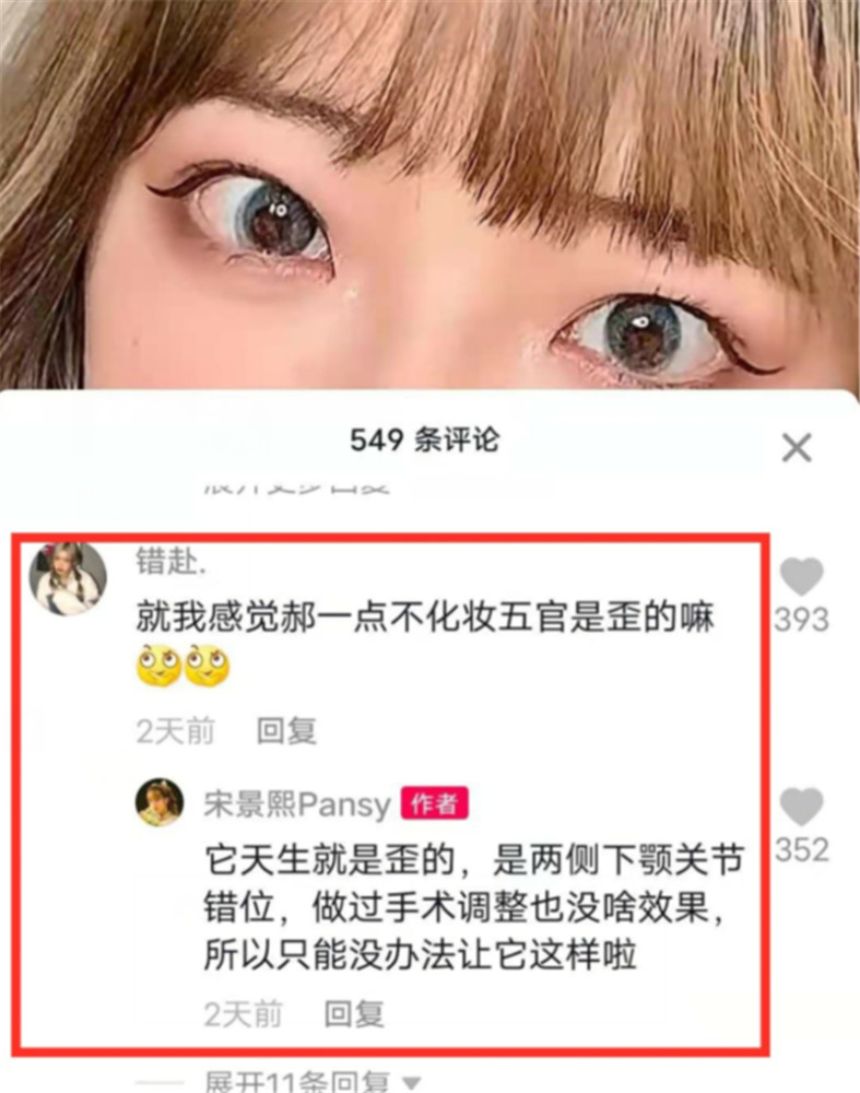 大方承认它天生就是歪的,两侧下颚关节错位,曾经去做了整容调整都没用