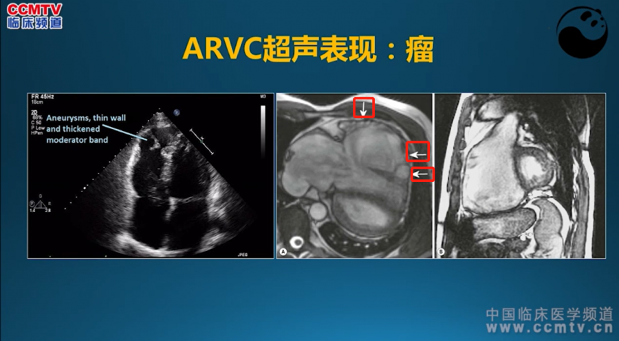 5步法读懂超声心动图90的医生都不知道