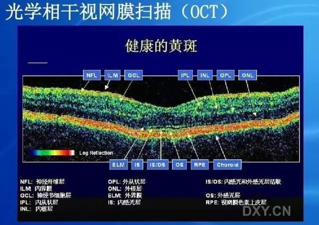 眼底病|眼底病检查与病例分析