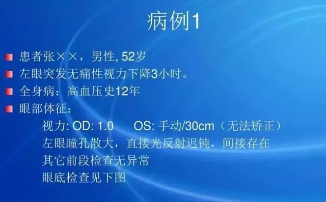 眼底病|眼底病检查与病例分析