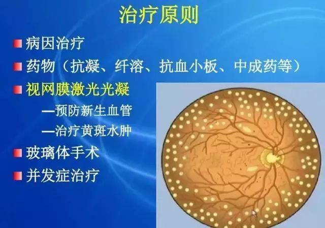 眼底病|眼底病检查与病例分析