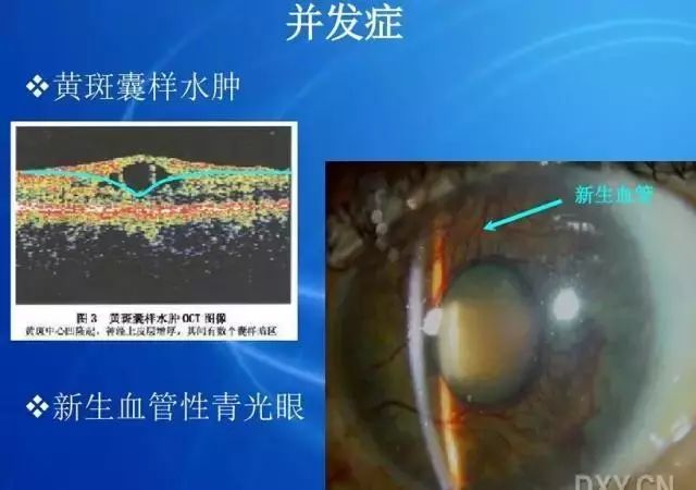 眼底病|眼底病检查与病例分析