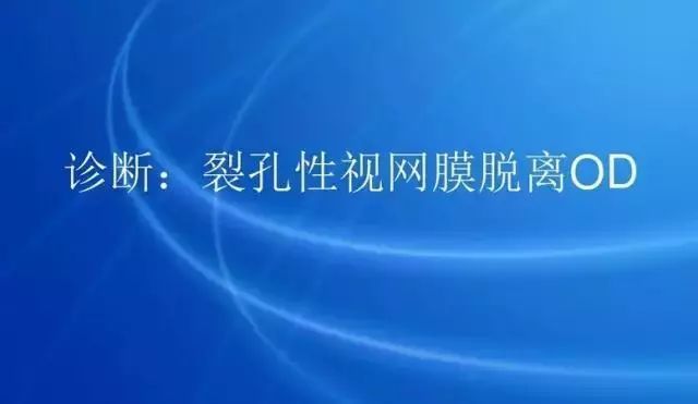 眼底病|眼底病检查与病例分析