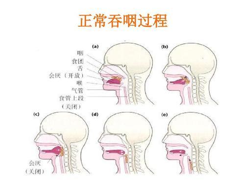 吞嚥困難真要命,hmb來救你!