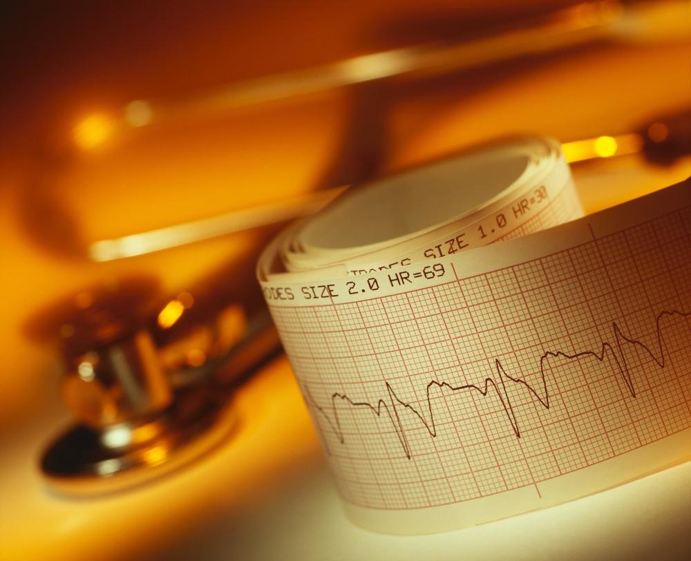 心脏|去医院检查心脏时，记得要检查这3个心脏项目，一个都不能忽略