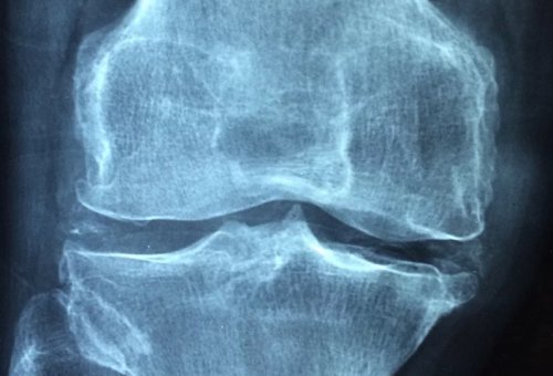 钙片|一天当中什么时间吃钙片最好？