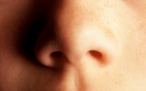 鼻炎|春天要重点养鼻