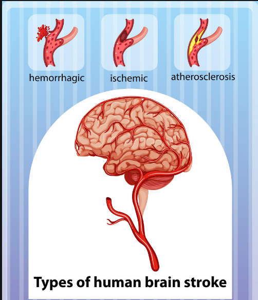 初春,打好心脑血管"保卫战"_腾讯新闻