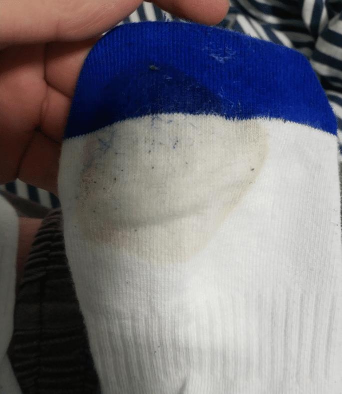 "才换的袜子脚心就这么出汗,很疑惑这是为什么?哈哈!"_腾讯新闻