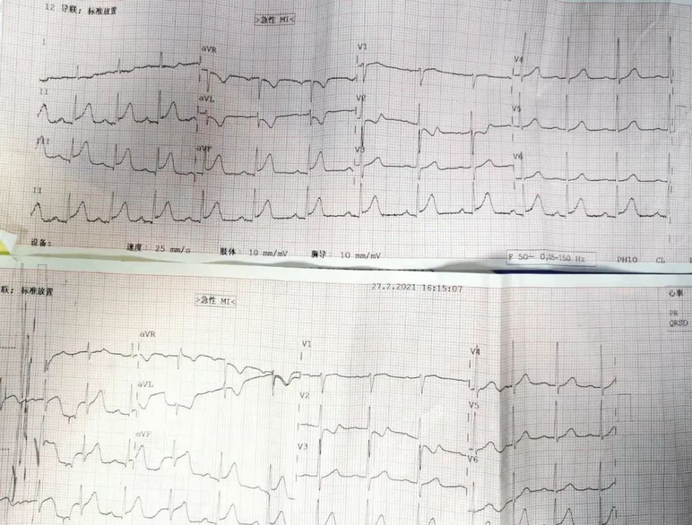 m老师|健康｜120急救中心专家心肌梗死 他亲自指挥抢救自己时突发心脏骤停……