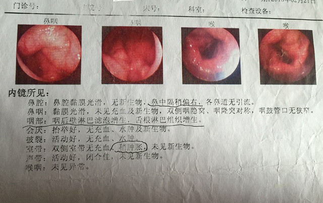 嘗試了緩解咽喉炎的多種小妙招終於治好了我的慢性咽炎