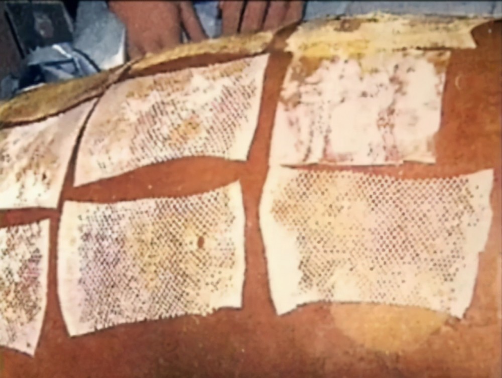 专家强行续命210天,每天都在目睹自己的身体腐烂_腾讯新闻