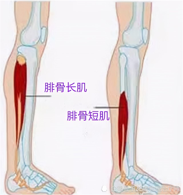 脚踝扭伤后总不好 一文告知您如何判断自我损伤的程度 该怎么应对处理 Qtc Care