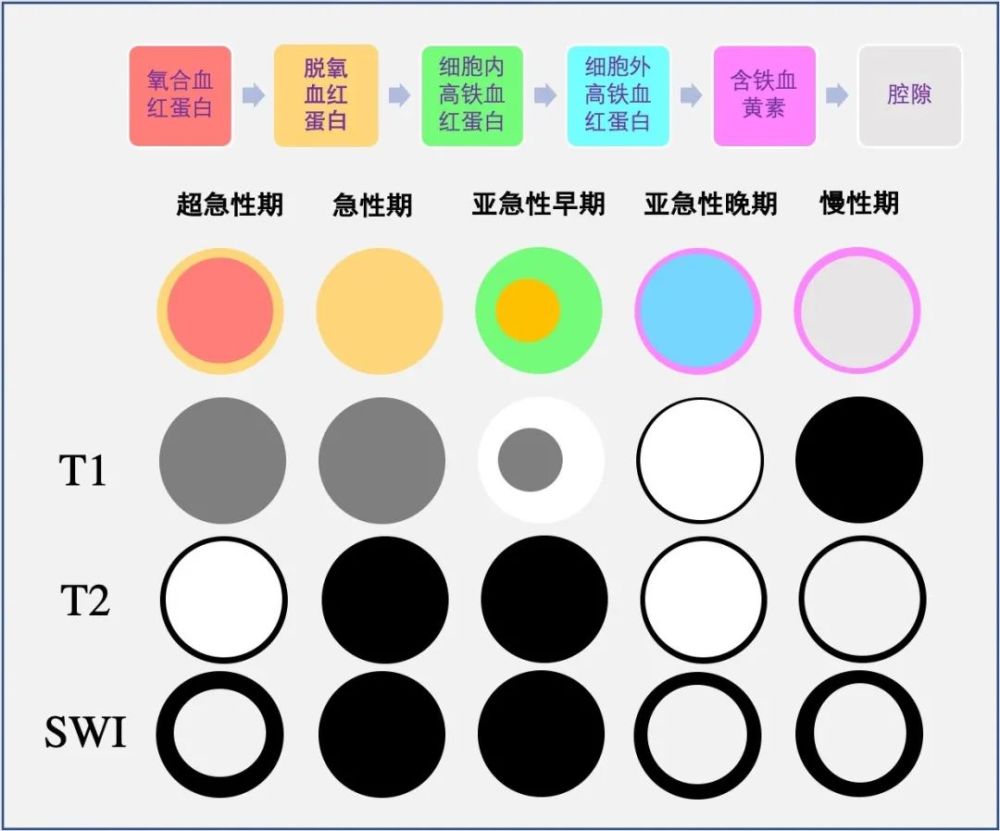 脑出血|理解是最好的记忆——细说脑出血核磁信号演变