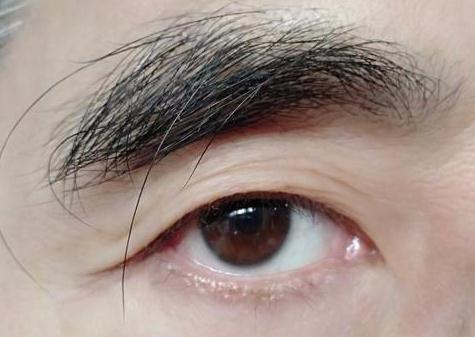 眉毛突然变长是长寿的特征还是身体出问题了
