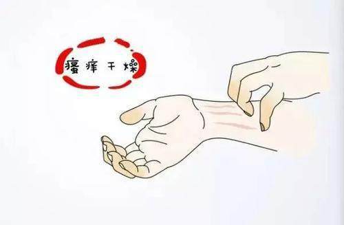 肾病|腿是肾的“侦查员”，腿上亮起3个“火把”，8成是肾要“报废”！