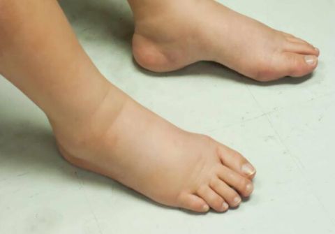 肾脏|身体有4种表现，当心是肾脏“求救”信号