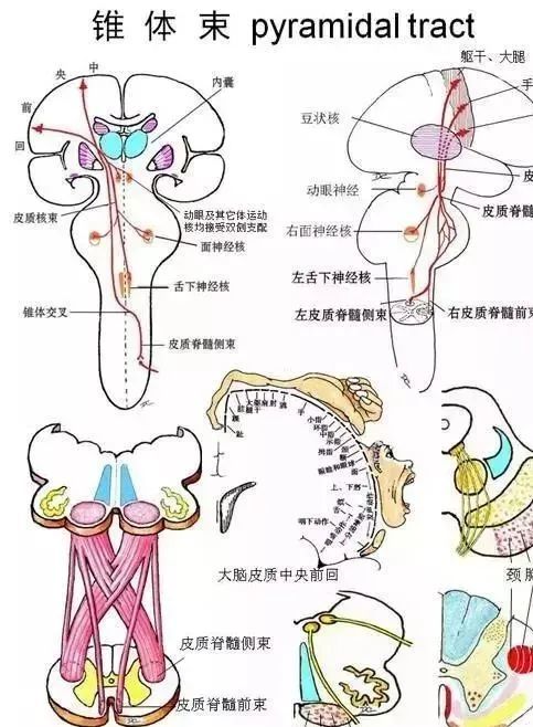 锥体束病变于休克期后,或隐袭起病的锥体束损害,在瘫痪侧出现肌张力