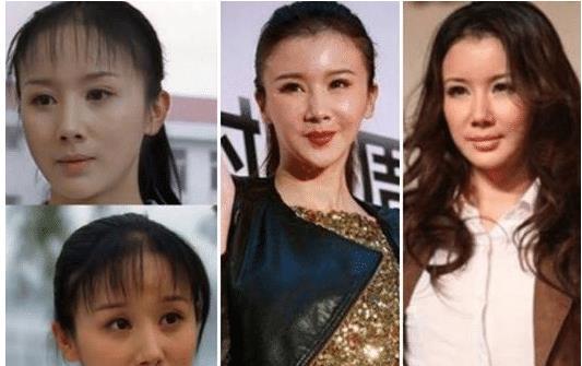 40岁孙菲菲整容过度尖下巴可以当开瓶器脸部及其不自然