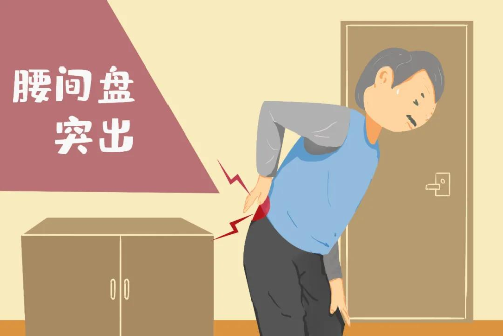 腰椎间盘突出症|当腰椎间盘突出症患者出现腿麻症状时，就麻烦了