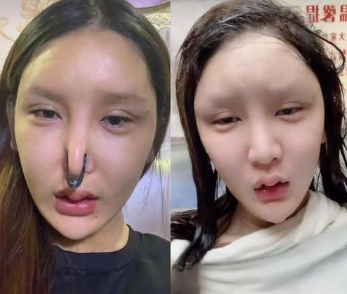 网红失败整容照大盘点前后对比超惨烈网友根本没眼看
