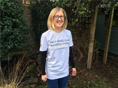 suzanne|女子患病一天跌倒8次 31年后才确诊