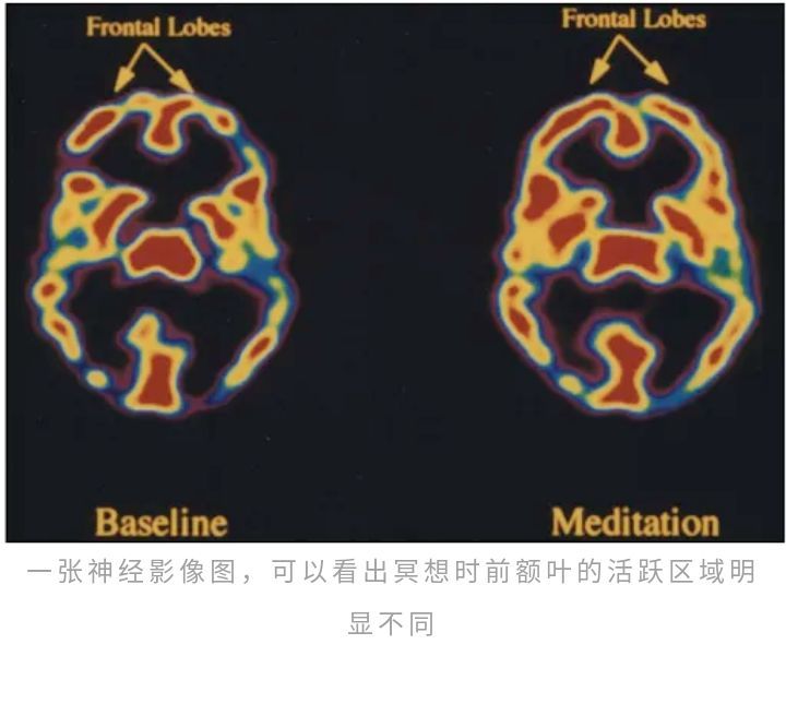 衰老|延寿20％、延缓大脑衰老，拥有2500年历史的冥想真的不只是玄学！